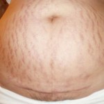 101308-anon1-5 101308-anon1-5