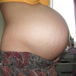 101408-anon2-3 101408-anon2-3