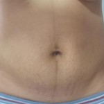101408-anon2-5 101408-anon2-5