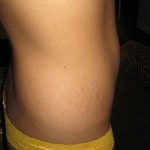 011809-anon2-2