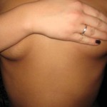 011809-anon2-3