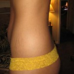 011809-anon2-4