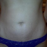 012609-anon2-4