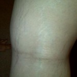 012609-anon2-5