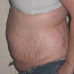 022409-anon-3 022409-anon-3