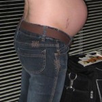 031609-anon-5