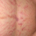 031809-anon2-2