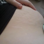 031809-anon2-5