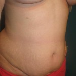 033009-anon-3