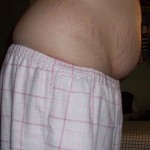 050609-anon2-3