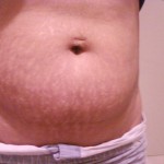 081109-roz-3 081109-roz-3