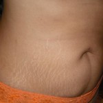 081909-anon-4