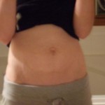 100309-anon-1 100309-anon-1