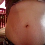 100709-anon-2 100709-anon-2