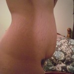 101209-anon-3