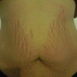 122309-anon2-5 122309-anon2-5