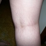 010510-anon-4