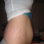031710-anon-8 031710-anon-8
