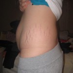 031710-anon-9 031710-anon-9