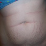 032310-alicia-6 032310-alicia-6