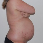 032910-anon-1 032910-anon-1