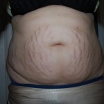 032910-anon-2 032910-anon-2