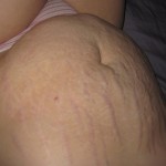 042010-anon-2 042010-anon-2