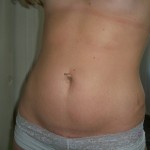 042210-anon-5 042210-anon-5