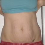 042310-anon-1 042310-anon-1