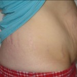 042310-anon-2 042310-anon-2