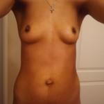 042310-anon2-4 042310-anon2-4