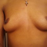 042310-anon2-5 042310-anon2-5