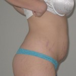 0428910-anon2-4 0428910-anon2-4