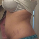 0428910-anon2-5 0428910-anon2-5