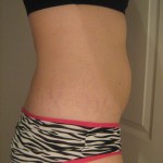 043010-anon-2