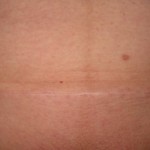 061010-anon-3
