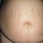 072810-anon-3 072810-anon-3
