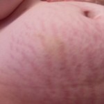 073010-anon-3