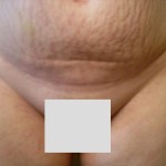 073010-anon-5