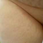 073010-anon-6