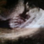 081110-anon-2 081110-anon-2