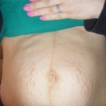 082610-anon-1 082610-anon-1