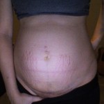 093010-anon-1 093010-anon-1