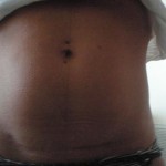 100610-anon-5 100610-anon-5