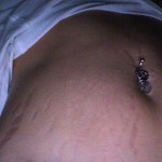 110510-anon2-3 110510-anon2-3