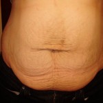 011811-anon-1 011811-anon-1