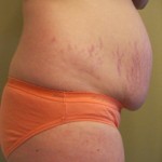 030411-anon2-1 030411-anon2-1