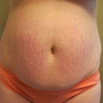 030411-anon2-3 030411-anon2-3