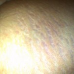 031111-anon-3