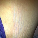 031111-anon-4